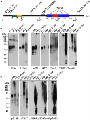 Dephosphorylation Passivates the Seeding Activity of Oligomeric Tau Derived From Alzheimer’s Brain